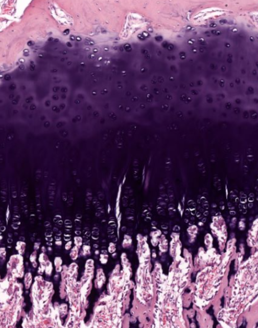 <p>the lighter purple section</p><p>part of endochondral ossification</p><p>non-dividing chondrocytes</p>