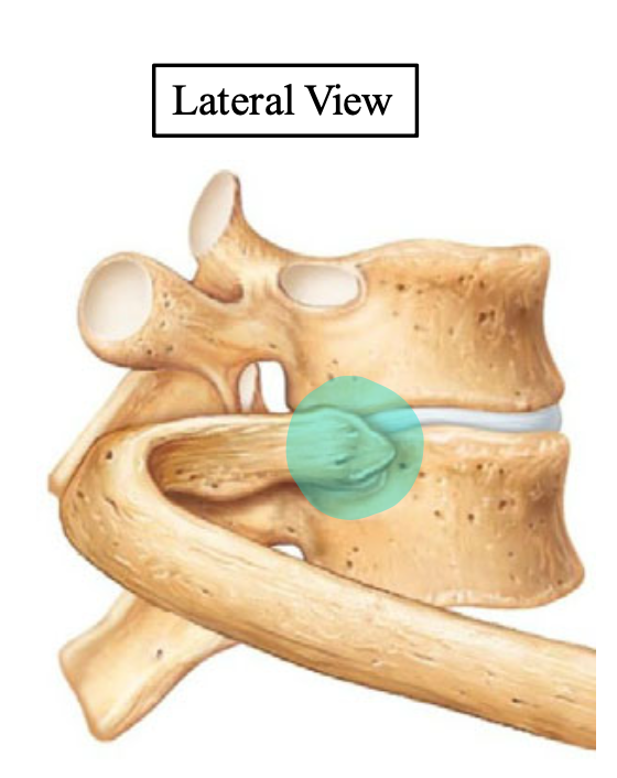 <p>Name the highlighted structure (on rib)</p>