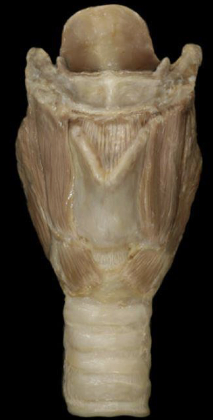 What structure is shown?