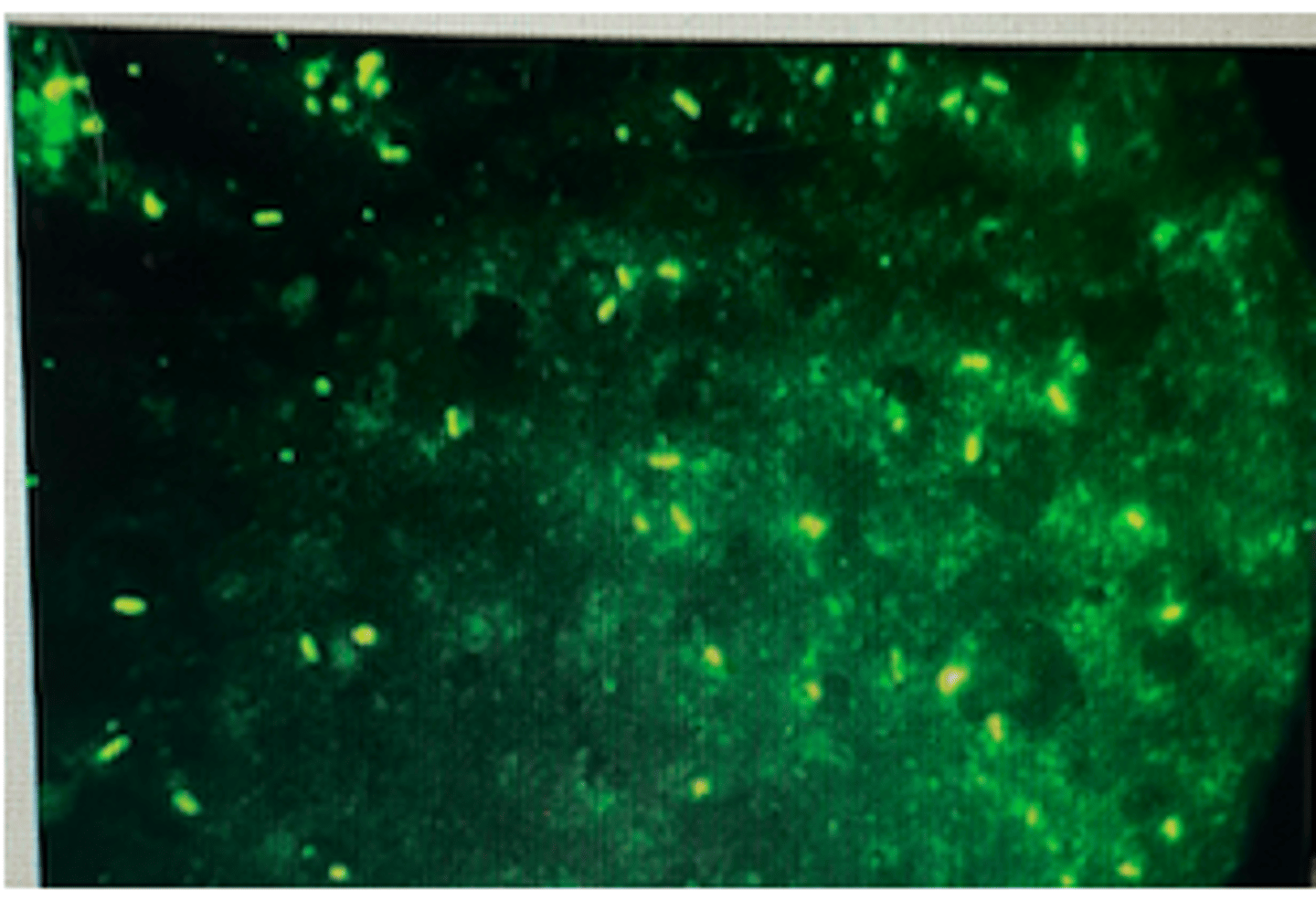 <p>What is considered to be the most important factor that triggers disease with Clostridium haemolyticum?</p>