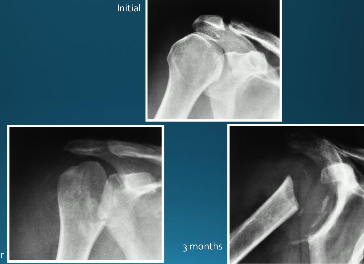 <p>what would this charcot joint be caused by </p>