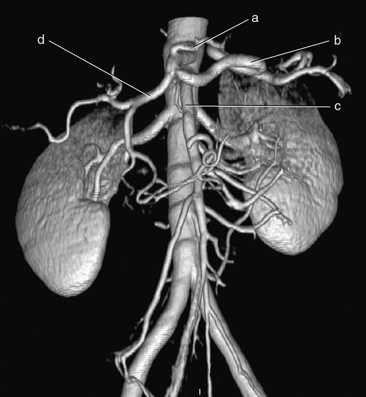 <p><span>Splenic Artery?</span></p>