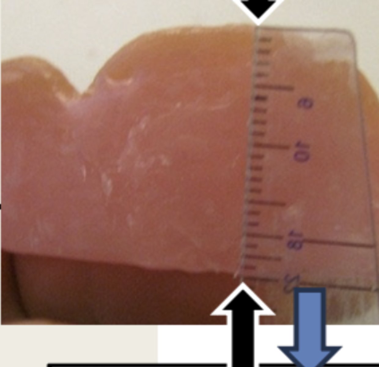 <p>What is the measurement at the area of the lateral incisors for the maxillary wax rim?</p>