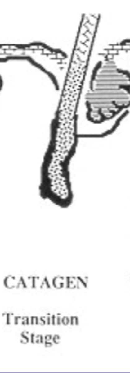 <p>(2% of the hair follicles)- - the transition period from the anagen to the telogen phase. The melanocytes in the follicle contract and cease to produce and distribute pigment granules.</p>