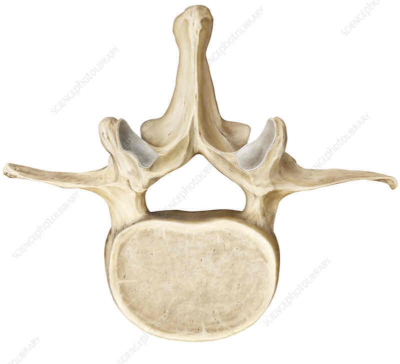 <p>Name this vertebrae and its defining characteristic</p>