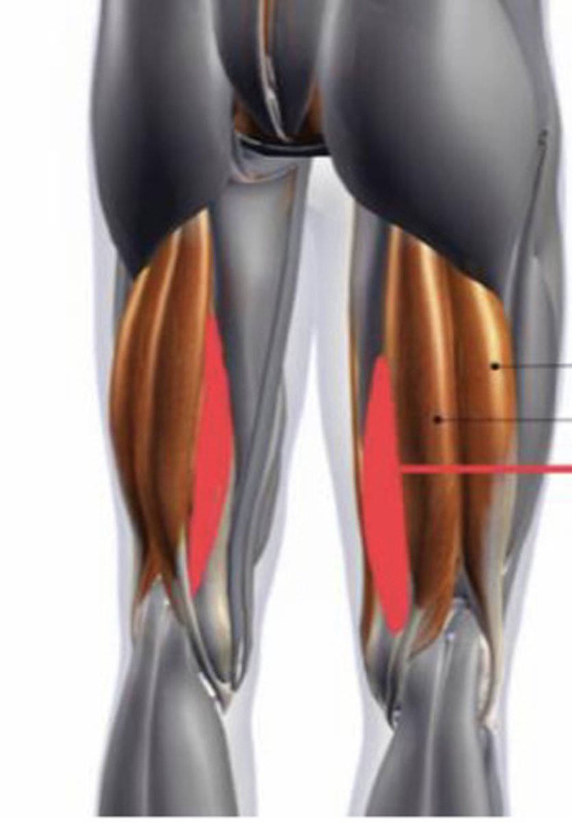 <p>Injury may mimic medial meniscus pathology</p>