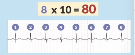 <ul><li><p>Count the R peaks</p><ul><li><p>For 6 seconds → Multiply R peaks by 10</p></li><li><p>For 3 seconds → Multiply R peaks by 20</p></li></ul></li></ul><p></p>