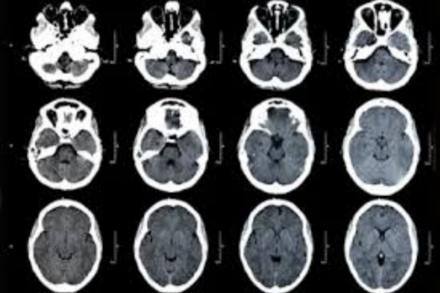 <p>CT scan</p>
