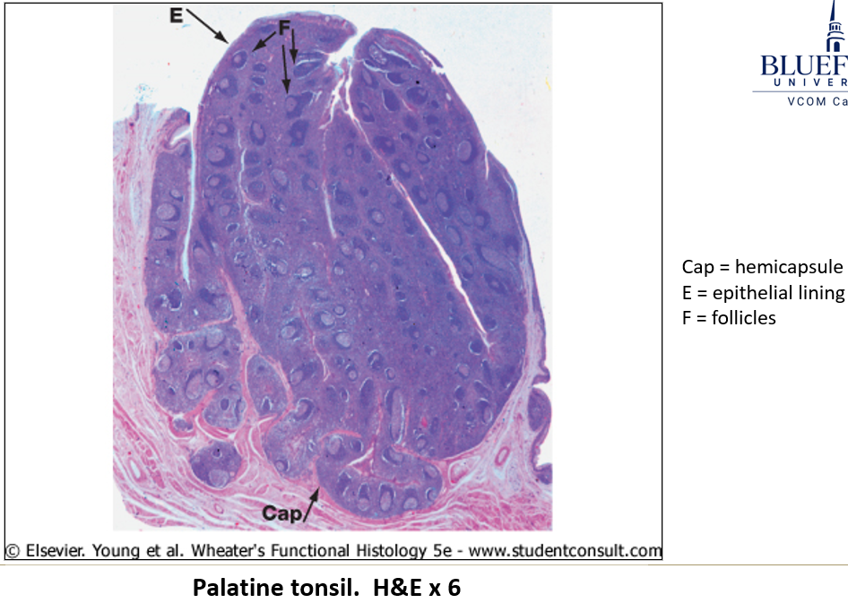 <ul><li><p><strong>Highly infolded epithelium</strong> with <strong>crypts</strong> to capture antigens.</p></li><li><p><strong>Diffuse and nodular lymphoid tissue</strong> inside crypts.</p></li><li><p><strong>Hemicapsule</strong> (dense irregular connective tissue).</p></li><li><p><strong>Germinal centers</strong> enlarge during infection, leading to a <strong>swollen or sore throat</strong>.</p></li></ul><p></p>