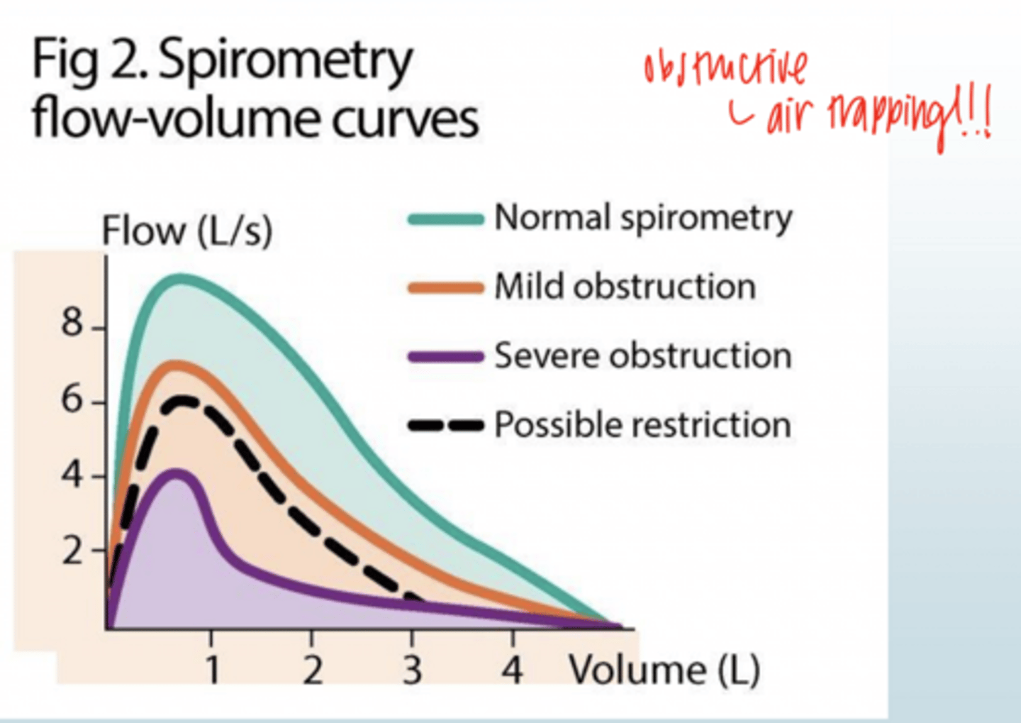 <p>air trapping!</p>