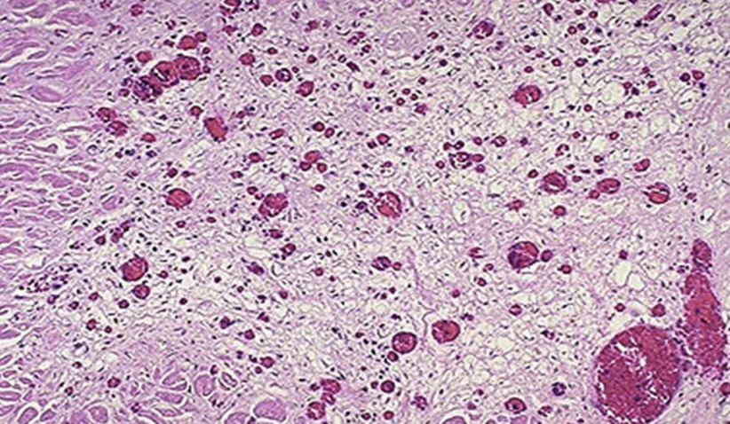 <p>Angioblasts</p>