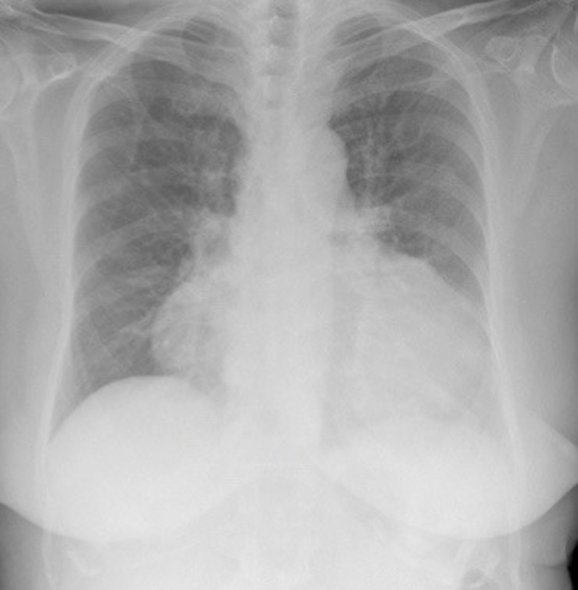 <p>What does this image show</p>