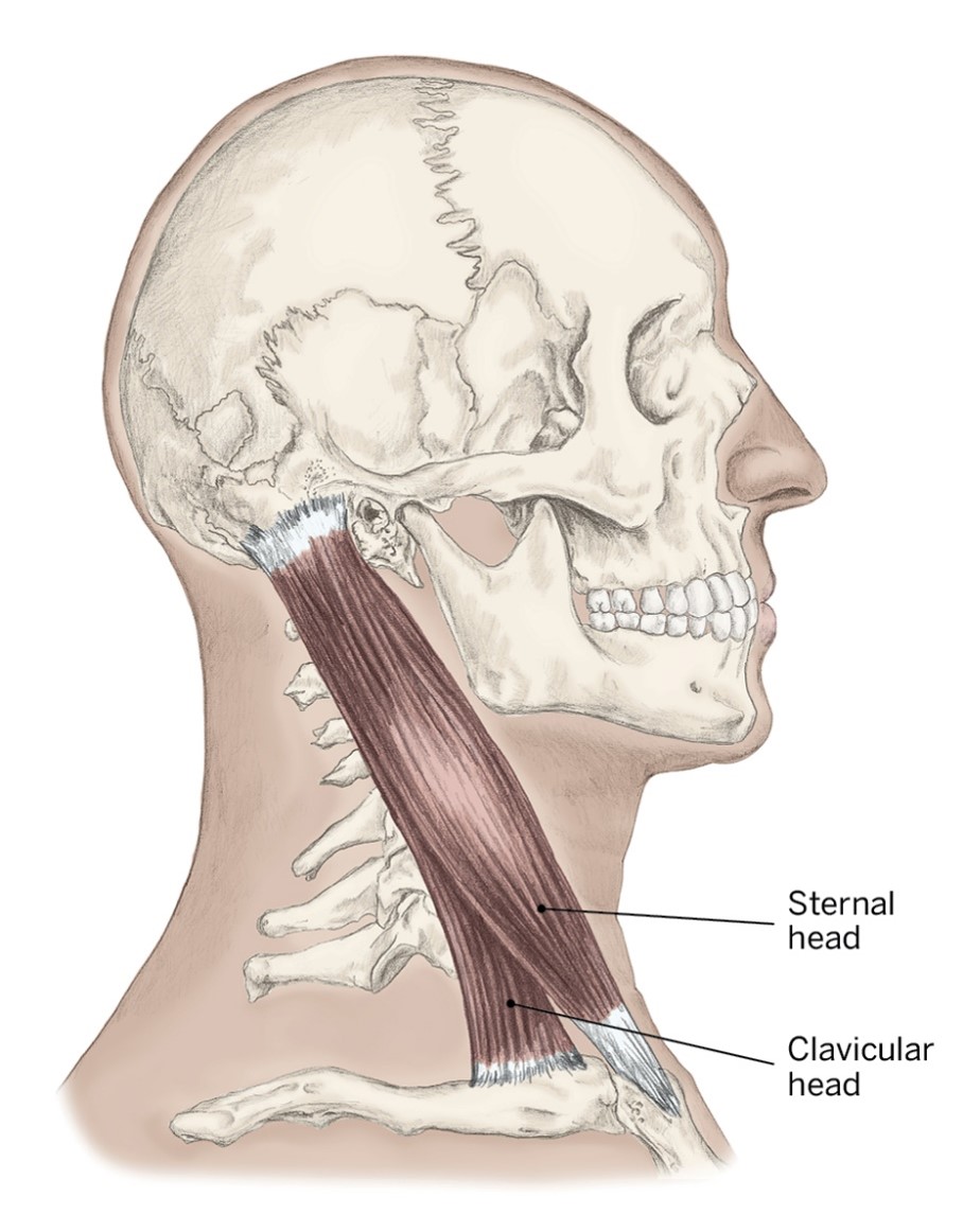 <p>O- Manubrium and Medial clavicle</p><p>I- Mastoid process and Lateral occiput</p><p>A- Cervical (ipsilateral) lateral bending and contralateral rotation</p>