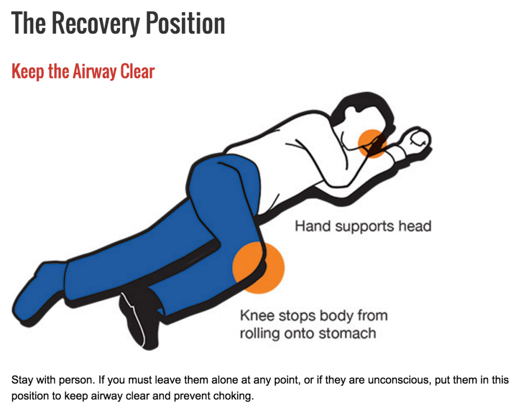 In first aid, the recovery position is one of a series of variations on a lateral recumbent or three-quarters prone position of the body, often used for unconscious but breathing casualties.