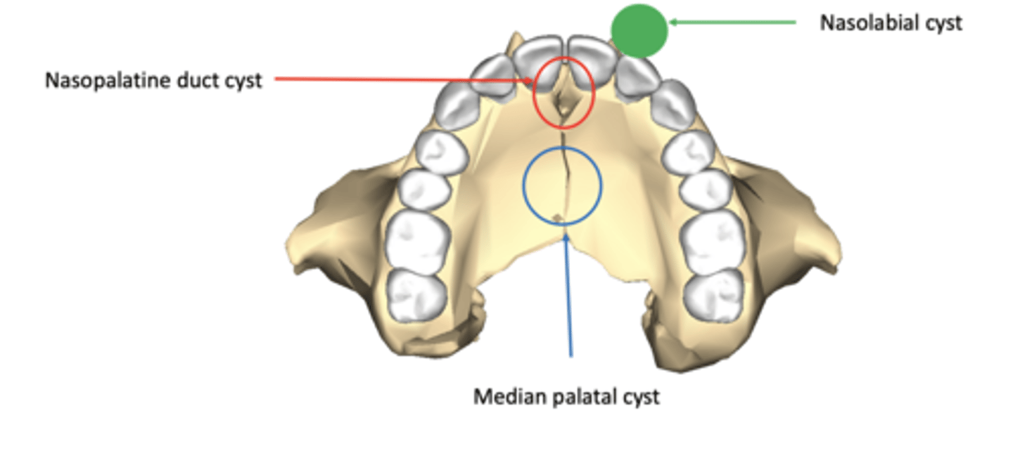 <p>nasopalatine duct cyst (most common one)</p><p>nasolabial cyst</p><p>median palatal cyst</p>