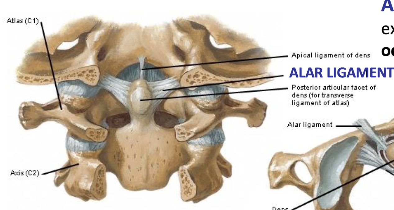 <p>Extend from <strong>Dens to occipital condyles</strong>; </p><p>limits rotation and lateral bending of the head;</p><p></p><p>think football tackling wrong* →</p><p>Hyperflexion injury produces instability of the head on the atlas. indicates an alar ligament tear (along w fracture of the dens)</p>