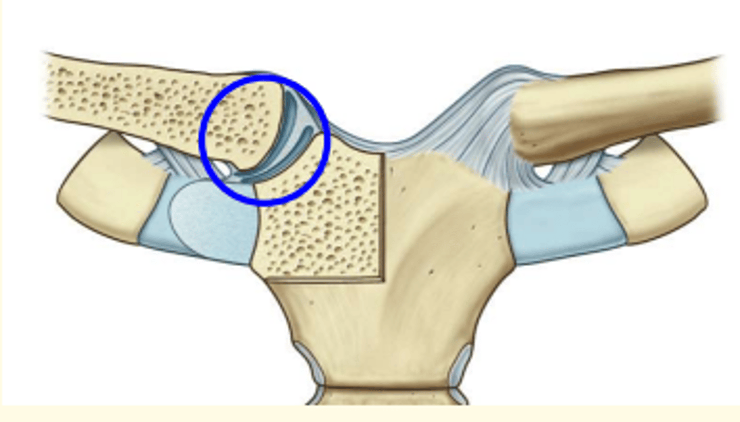 <p>Sternoclavicular joint</p>
