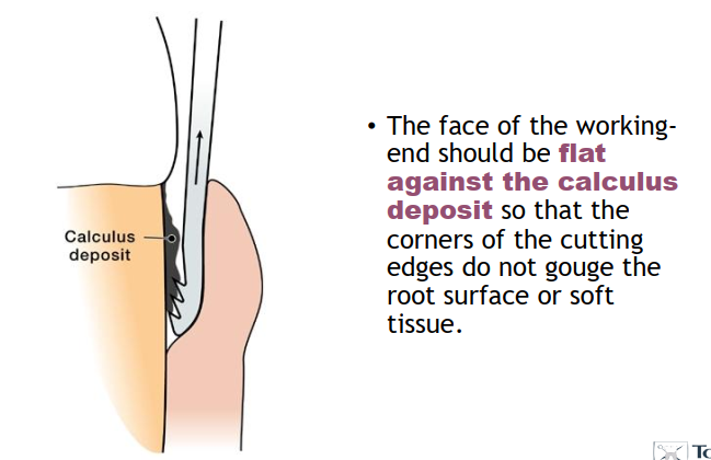 <ol><li><p>Adaptation of the working end to a calculus deposit </p></li><li><p>Resting lower shank AGAINST tooth. </p></li></ol><p></p>