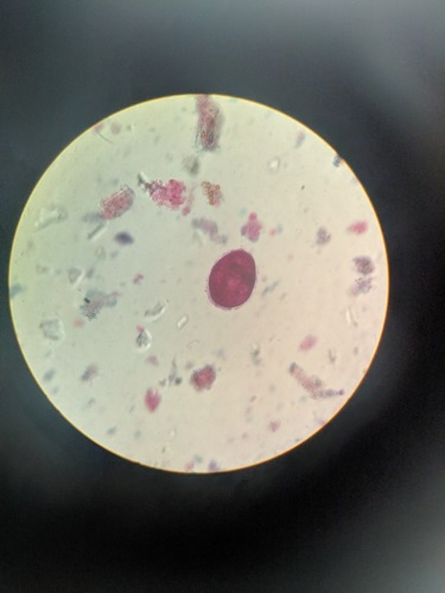 <p>Has cytostome (mouth) and micronucleus is outside of macronucleus</p><p>ciliated</p>