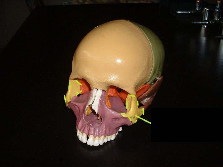 <p>cheekbone and outer part of the eye socket</p>