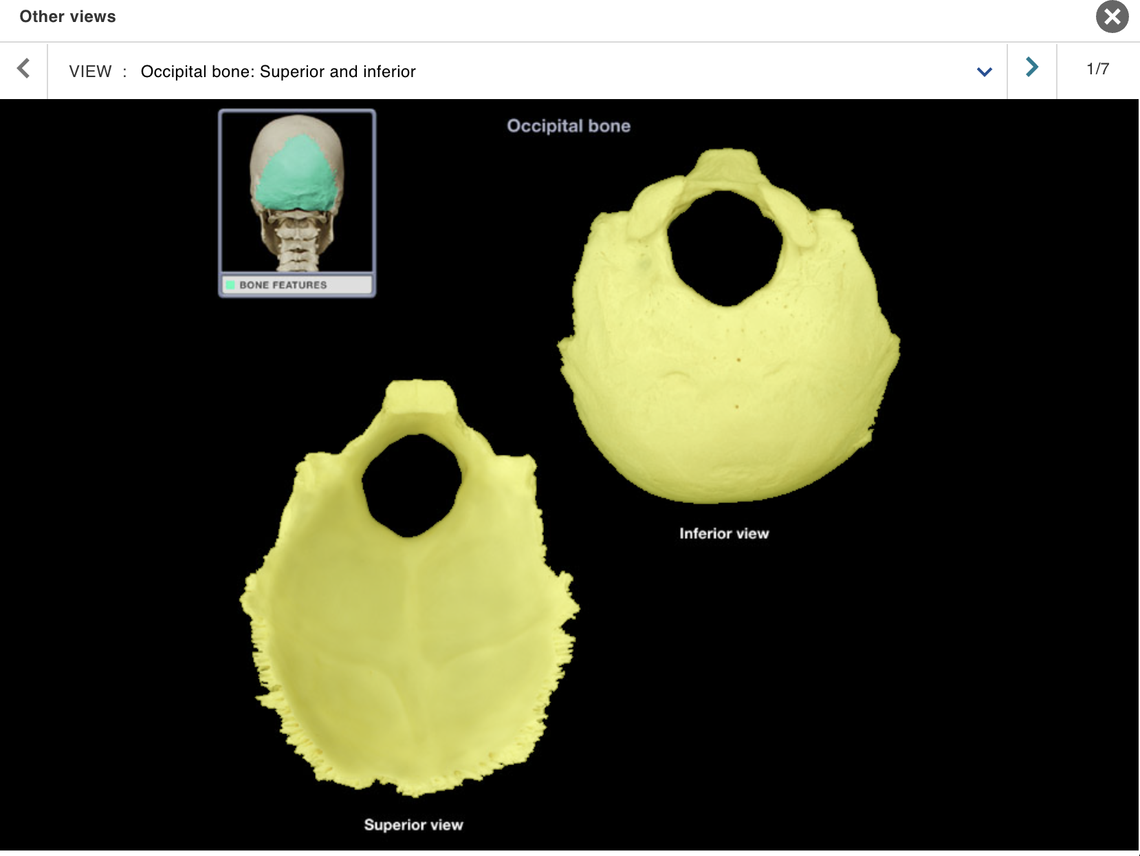 <p>Location:</p><p class="p1">• Skull (posterior and inferior)</p><p class="p1">Description:</p><ul><li><p>﻿﻿Irregular-shaped bone</p></li><li><p>﻿﻿Contains foramen magnum in central portion</p></li></ul><p class="p1">Comment:</p><ul><li><p>﻿﻿Forms most of posterior skull</p></li><li><p>﻿﻿Forms most of posterior cranial fossa</p></li><li><p>﻿﻿Articulates with parietal bone at lambdoid suture, temporal bone at occipitomastoid and other sutures, and sphenoid bone at spheno-occipital synchondrosis</p></li><li><p>﻿﻿Articulates with atlas (C1 vertebra)</p></li></ul><p></p>