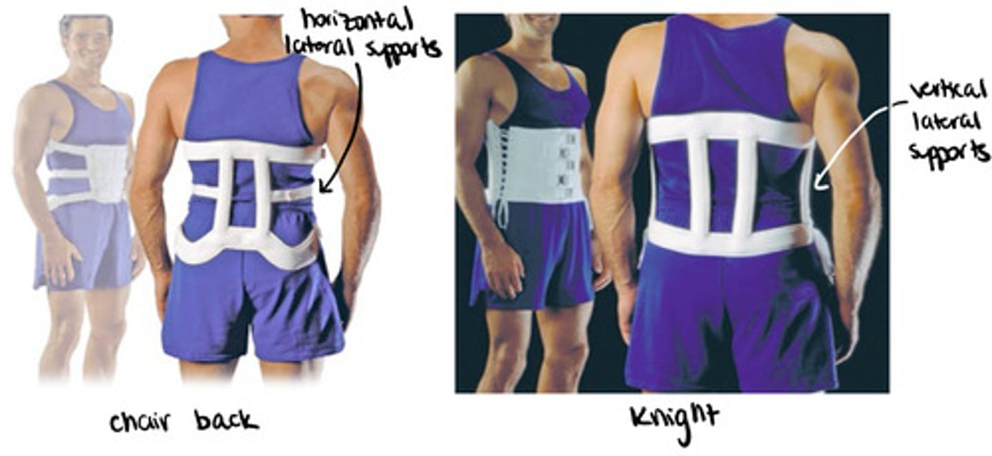 <p>all are conventional rigid LSOs with corset front</p><p>Chairback</p><p>horizontal lateral supports</p><p>more contoured</p><p>rigid lateral and posterior frame</p><p>limit EXT and lateral bending</p><p>hydrostatic compression</p><p>Knight</p><p>vertical lateral supports</p><p>less contoured</p><p>rigid lateral and posterior frame</p><p>limit EXT and lateral bending</p>