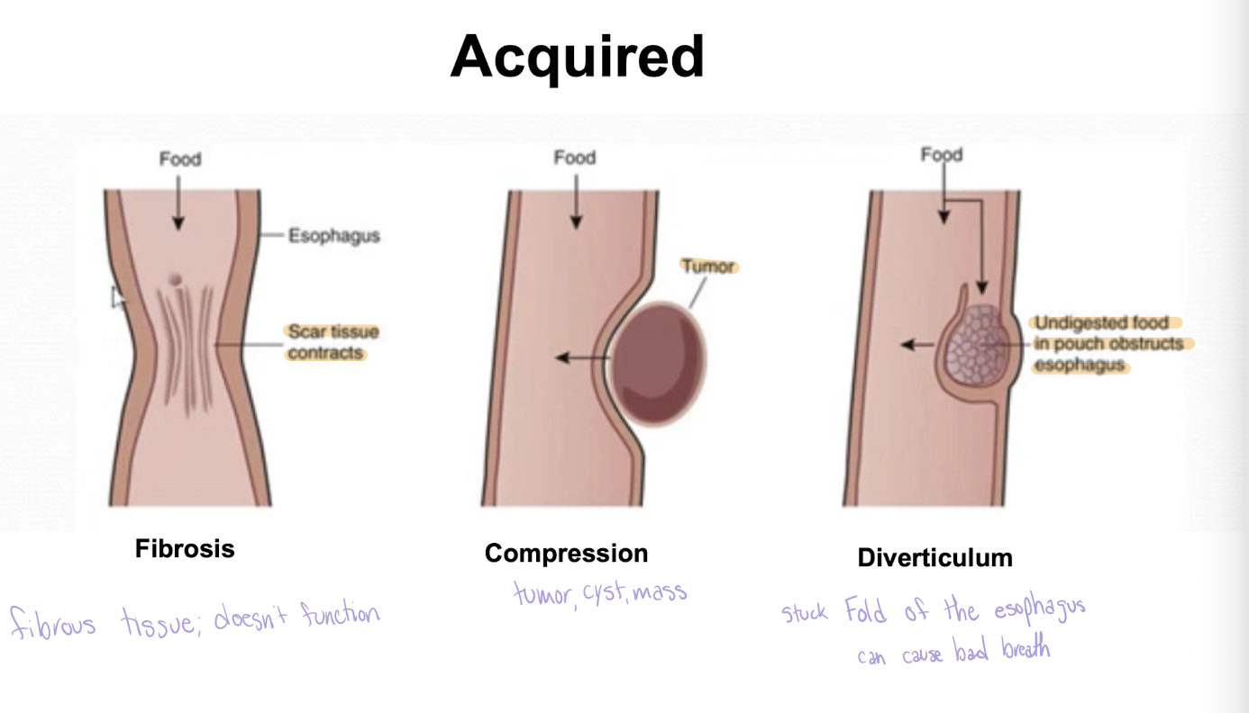 <ul><li><p>Difficulty of swallowing</p></li><li><p>Causes</p><ul><li><p>Neurological deficit</p></li><li><p>Muscular disorder</p></li><li><p>Mechanical obstruction</p></li></ul></li><li><p>Results/presentation</p><ul><li><p>Pain with swallowing</p></li><li><p>Inability to swallow larger pieces of solid material </p></li><li><p>Difficult swallowing liquids </p></li></ul></li></ul><p></p>
