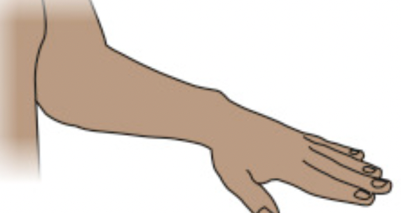 <p>What type of movement is this?</p>