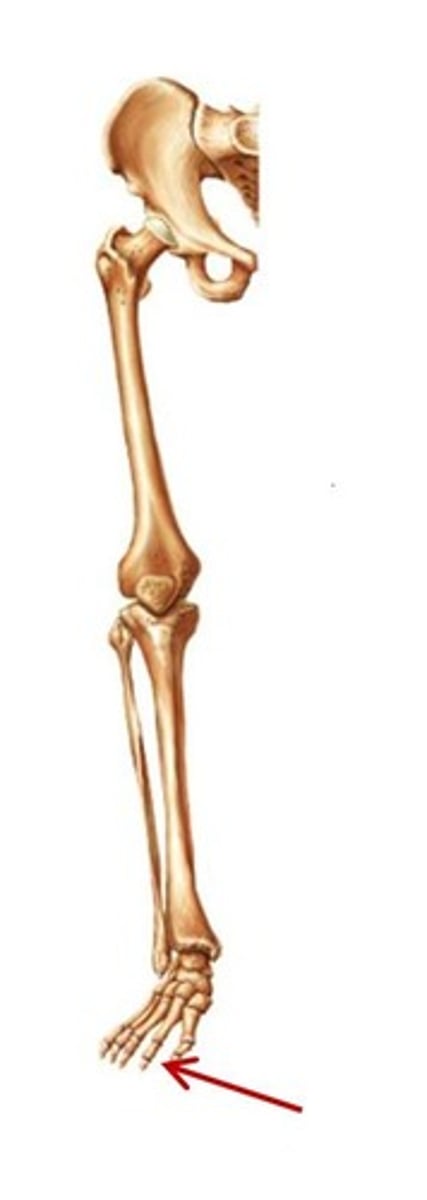 <p>ID bone group</p>