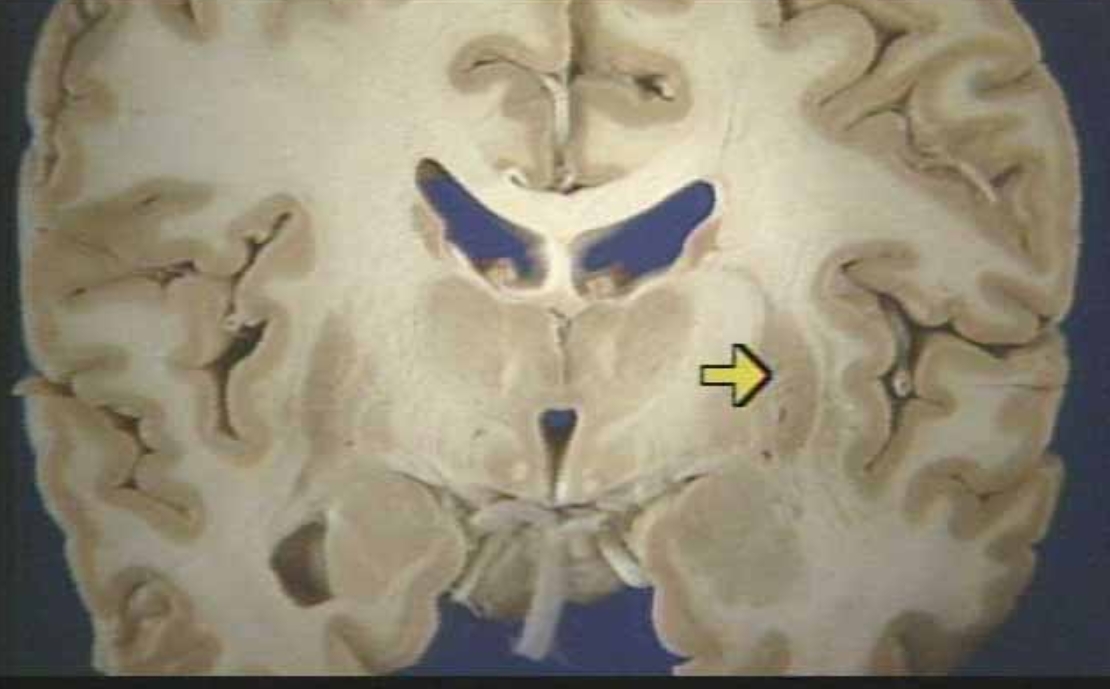 <p>What is the arrow pointing at?</p>