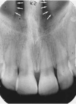 <p>identify the structure </p>