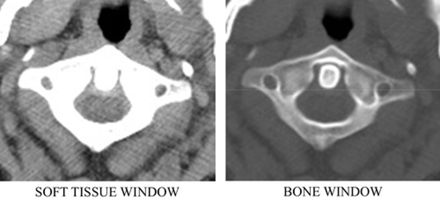 <p>Ability to alter the brightness and contrast of a digital image, following processing</p>