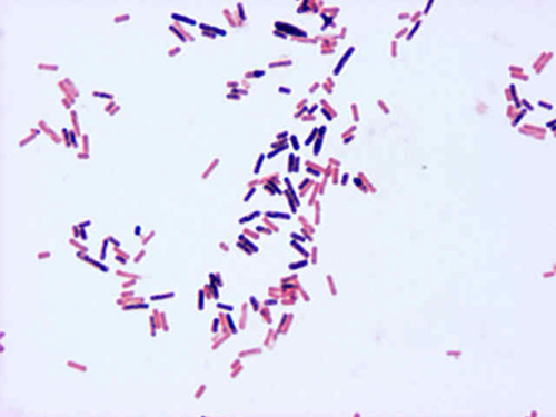 <p>How would you report this stain?</p>