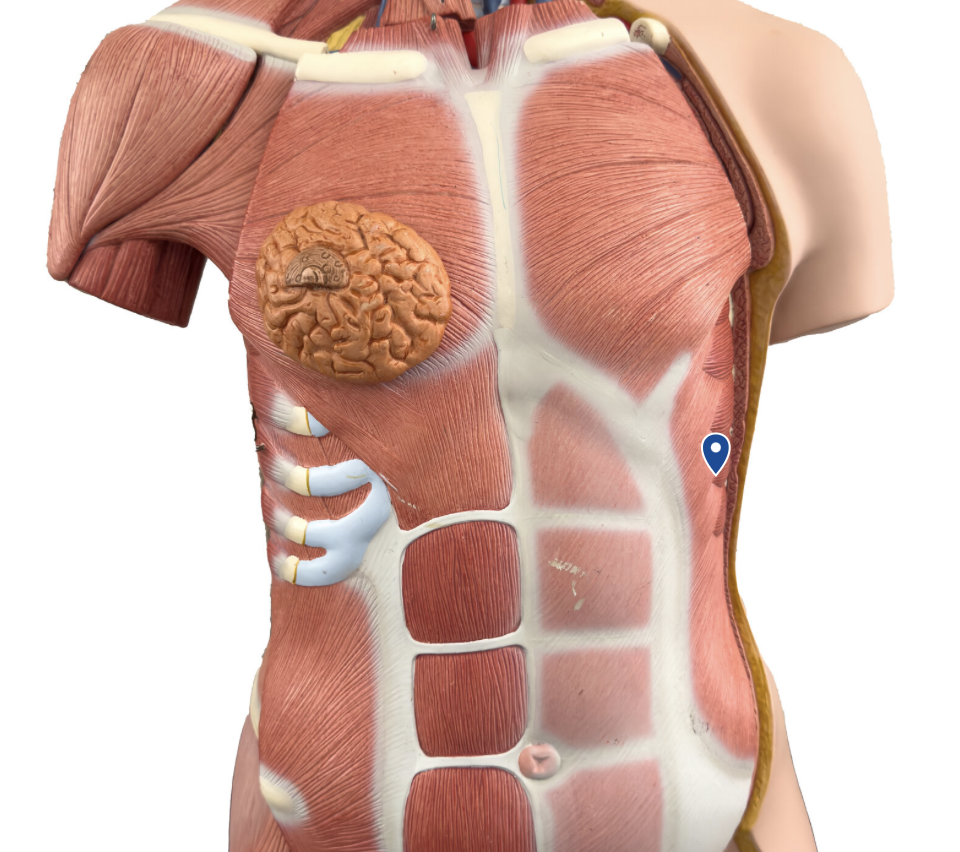 <p>What muscle is the arrow pointing to?</p>