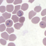 <p>Dr. Vicente Y. Belizario Jr.</p>