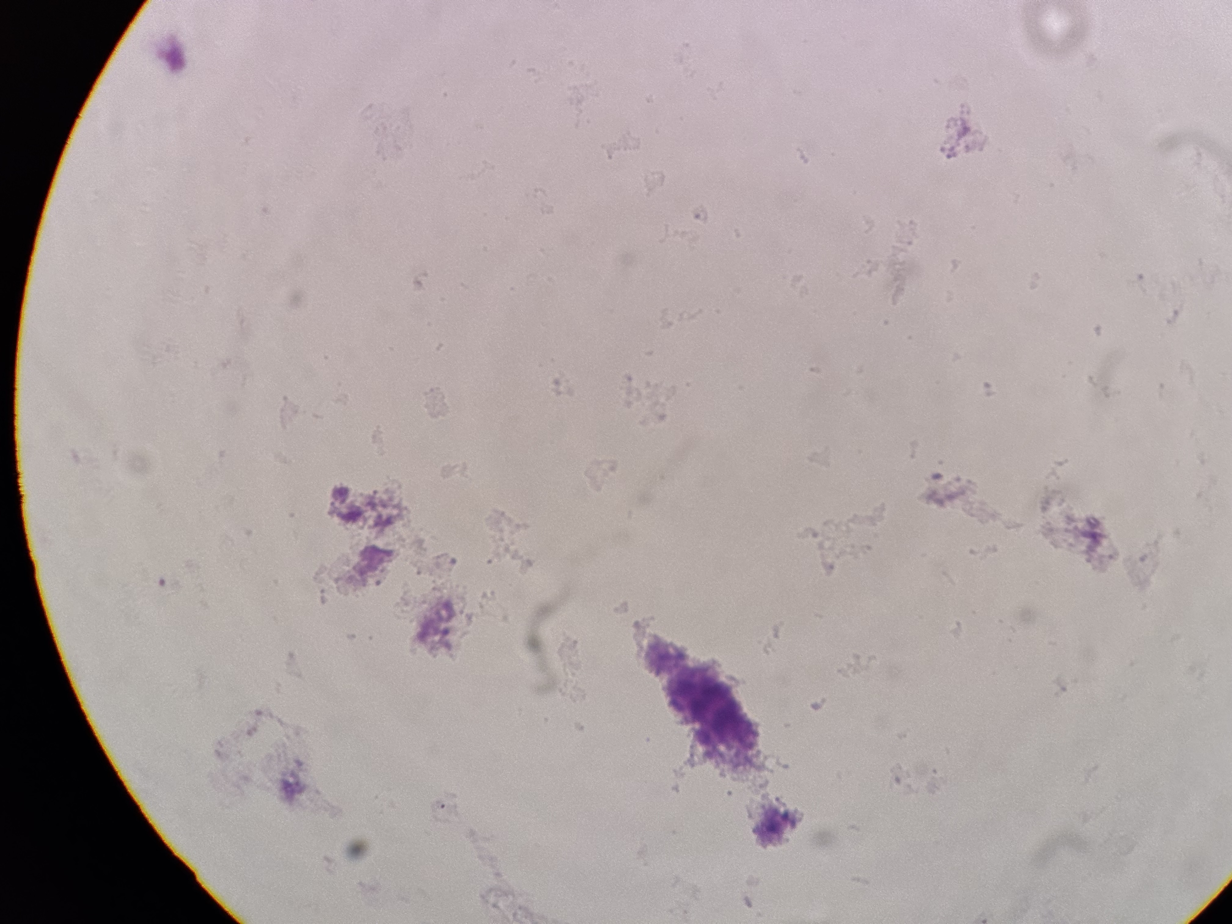 <p>S. aureus</p>
