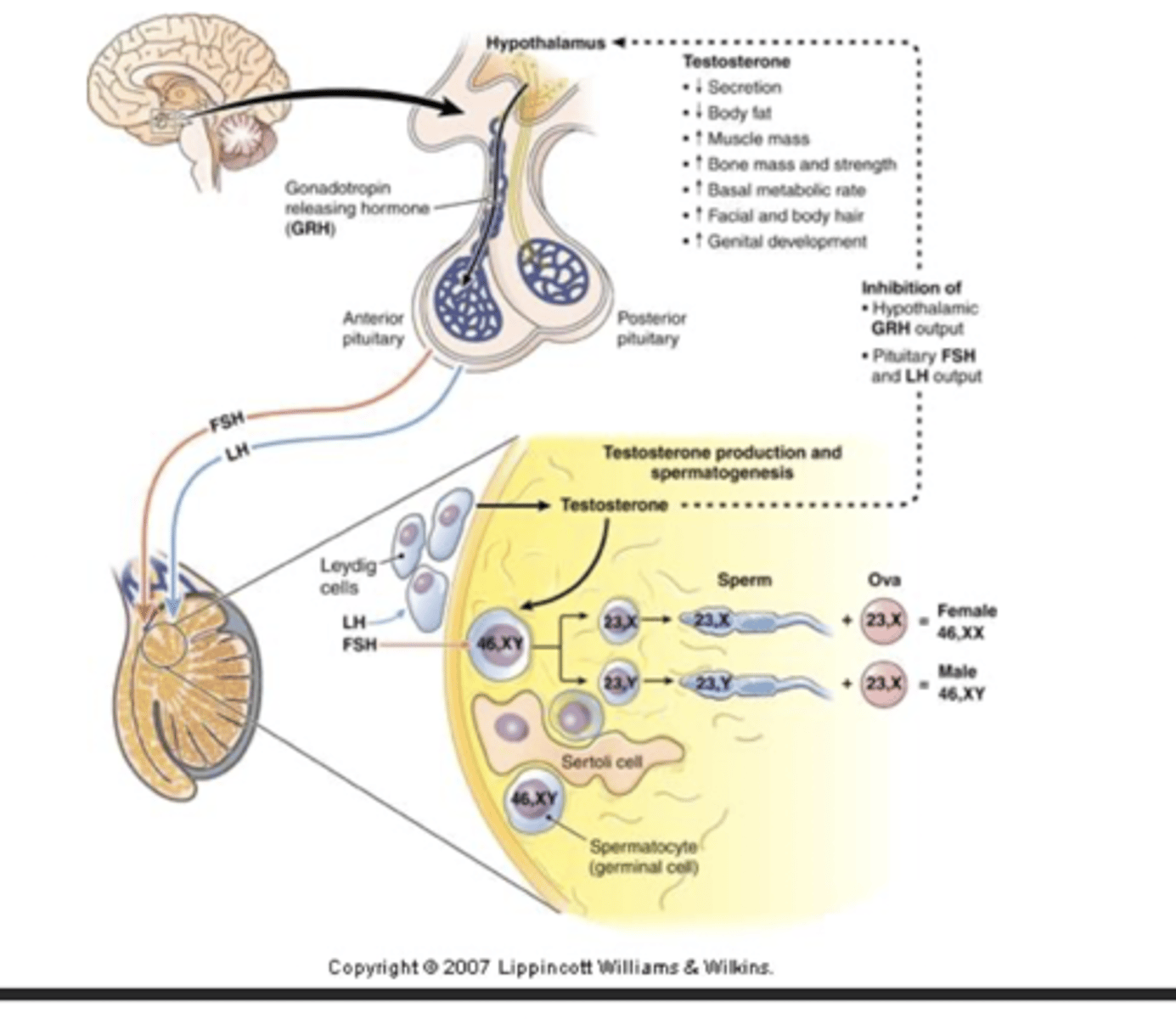 <p>surgery, radiation, orchiectomy and antitestosterone drugs, chemotherapy</p>