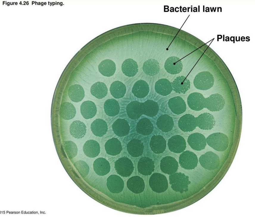 <p>Explain <strong>plaque assay pipeline</strong></p>