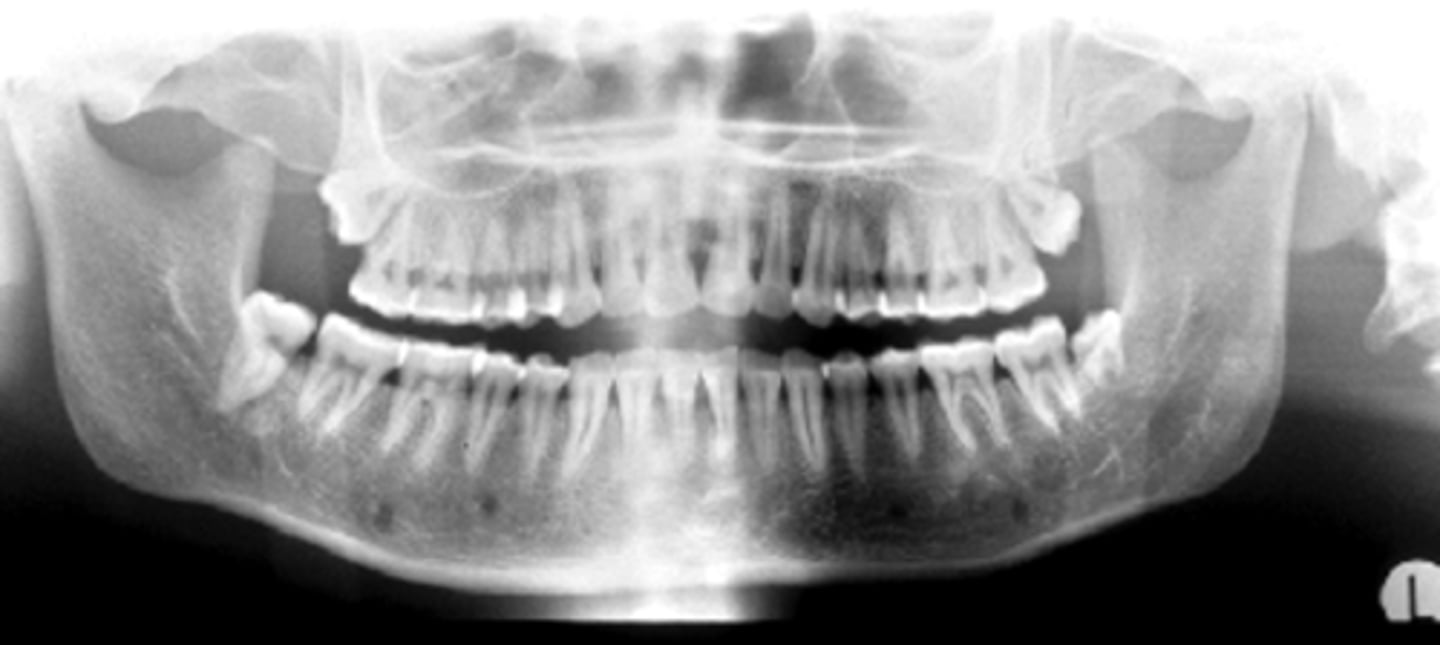 <p>ID the positional error from the radiograph:</p>