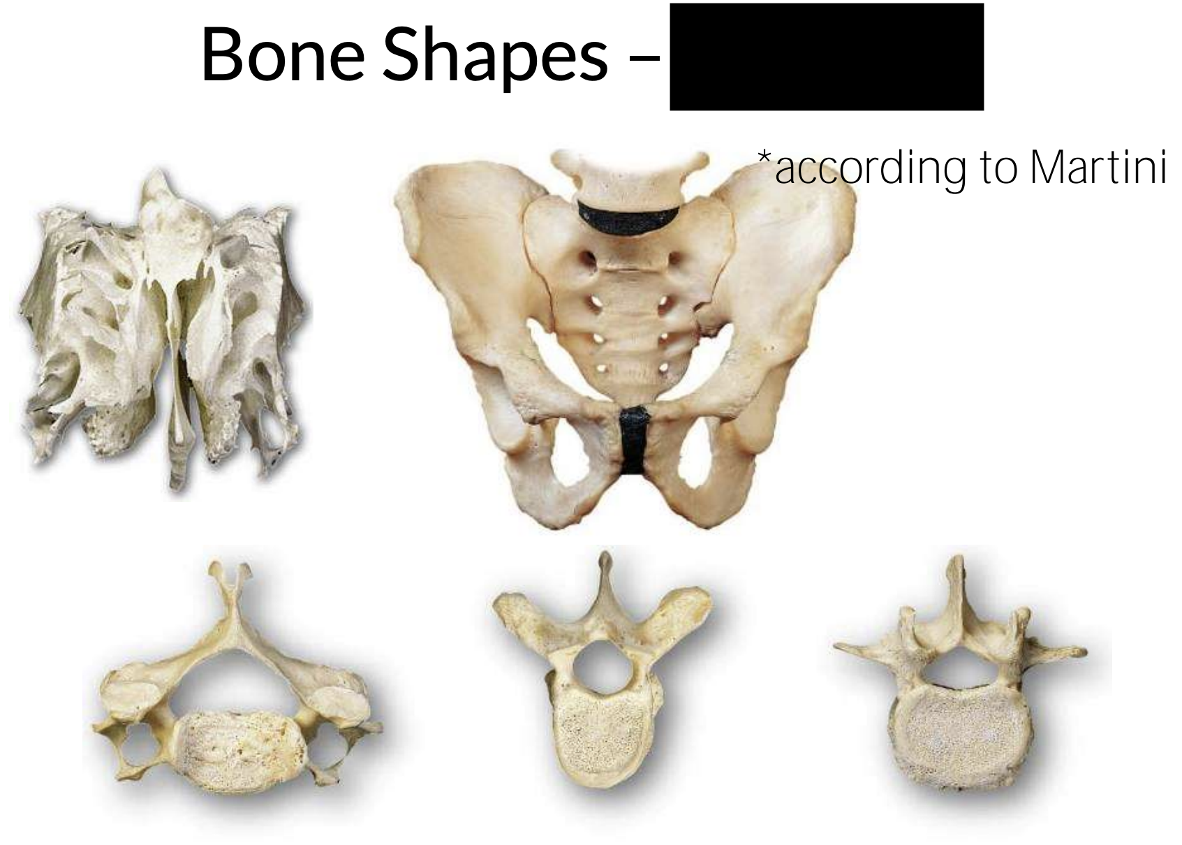 What bone shape is this?