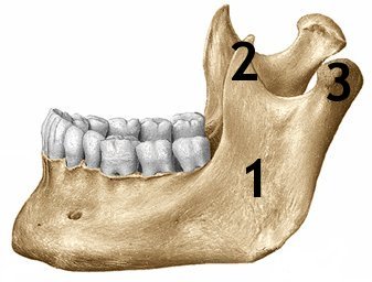 <p><strong>What is identified by the number 2 in this image below?</strong><br>A. Condyloid process<br>B. TMJ<br>C. Coronoid process<br>D. Mandibular Coronoid process</p>