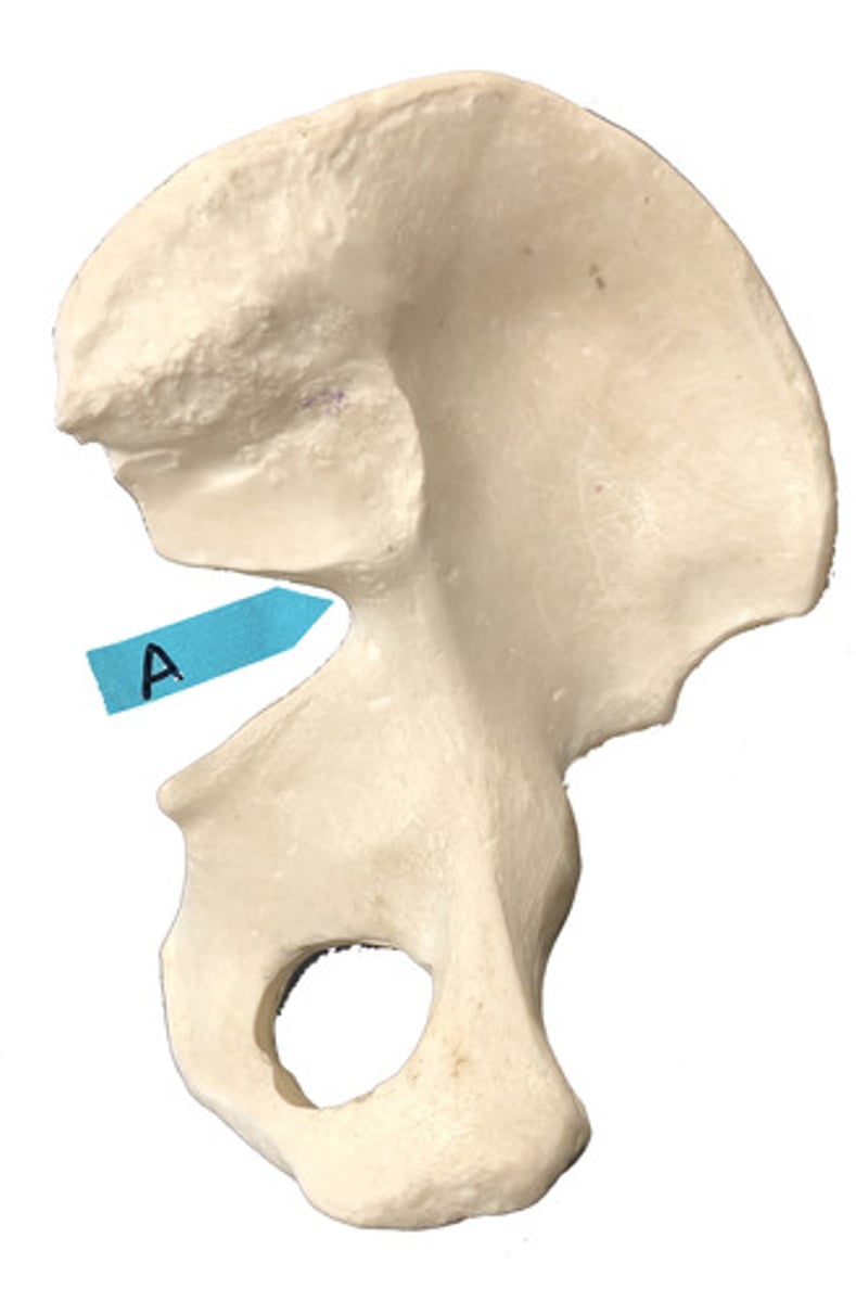 <p>Identify this bone marking.</p>
