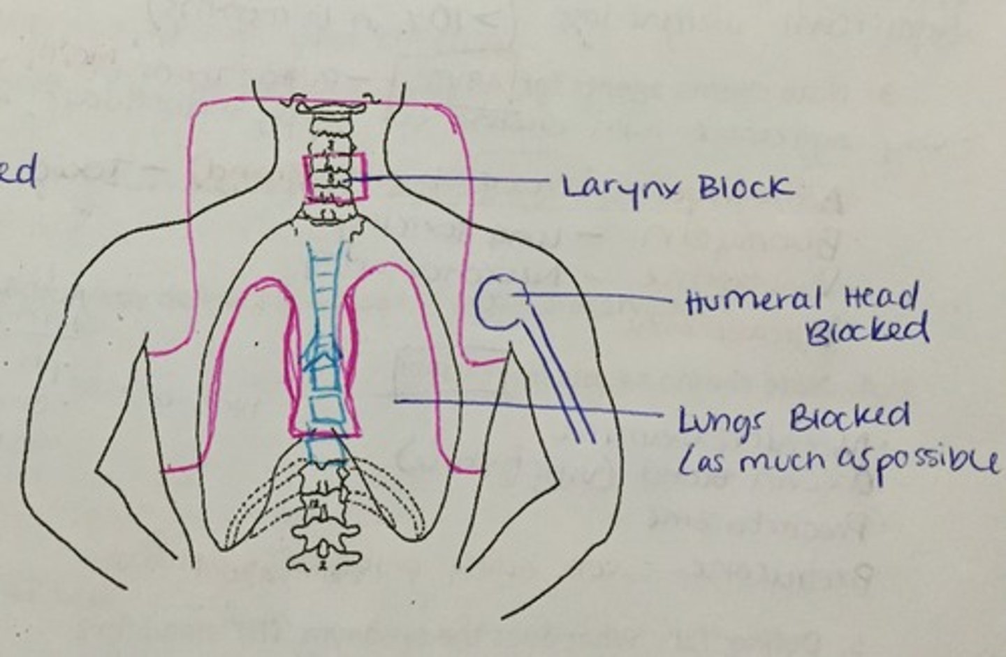 <p>Cervical, submandibular, axillary, supraclavicular, mediastinal and hilar lymph nodes</p>