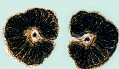<p>What genera of botfly does this spiracle belong to?</p>