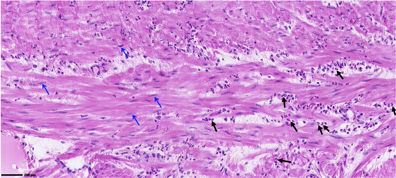 <ol><li><p>ID the cells at the black arrows.</p></li><li><p>ID the cells at the blue arrows</p></li></ol>