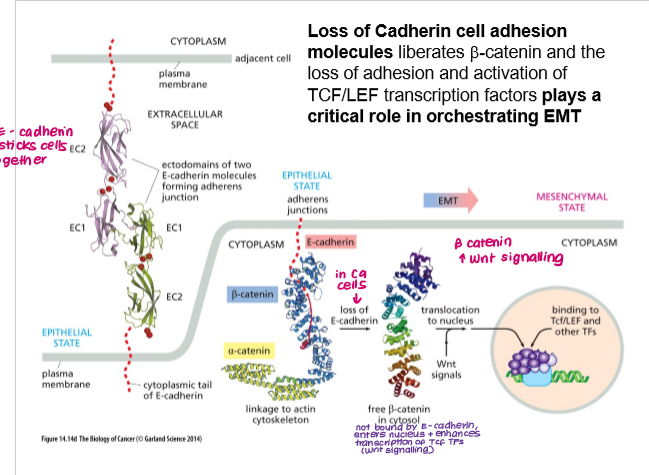 <p><strong>Loss of E-cadherin: </strong></p><ul><li><p>beta-catenin no longer bound to membrane</p></li><li><p>beta-catenin migrates to nucleus and induces expression of TFs (Tcf) → EMT</p></li></ul><p></p>