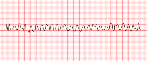 <p>Epinephrine-patient is in vfib</p>