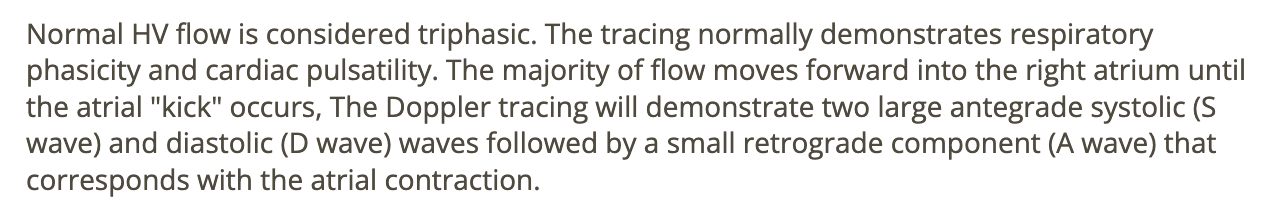 <p>d) 2 large ANTEgrade diastolic + systolic waves follow by a small RETROgrade component that corresponds w/atrial contraction </p>