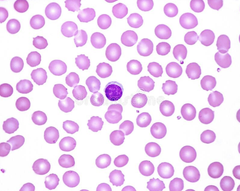 <p>are these cells normocytic, microcytic, or macrocytic?</p>