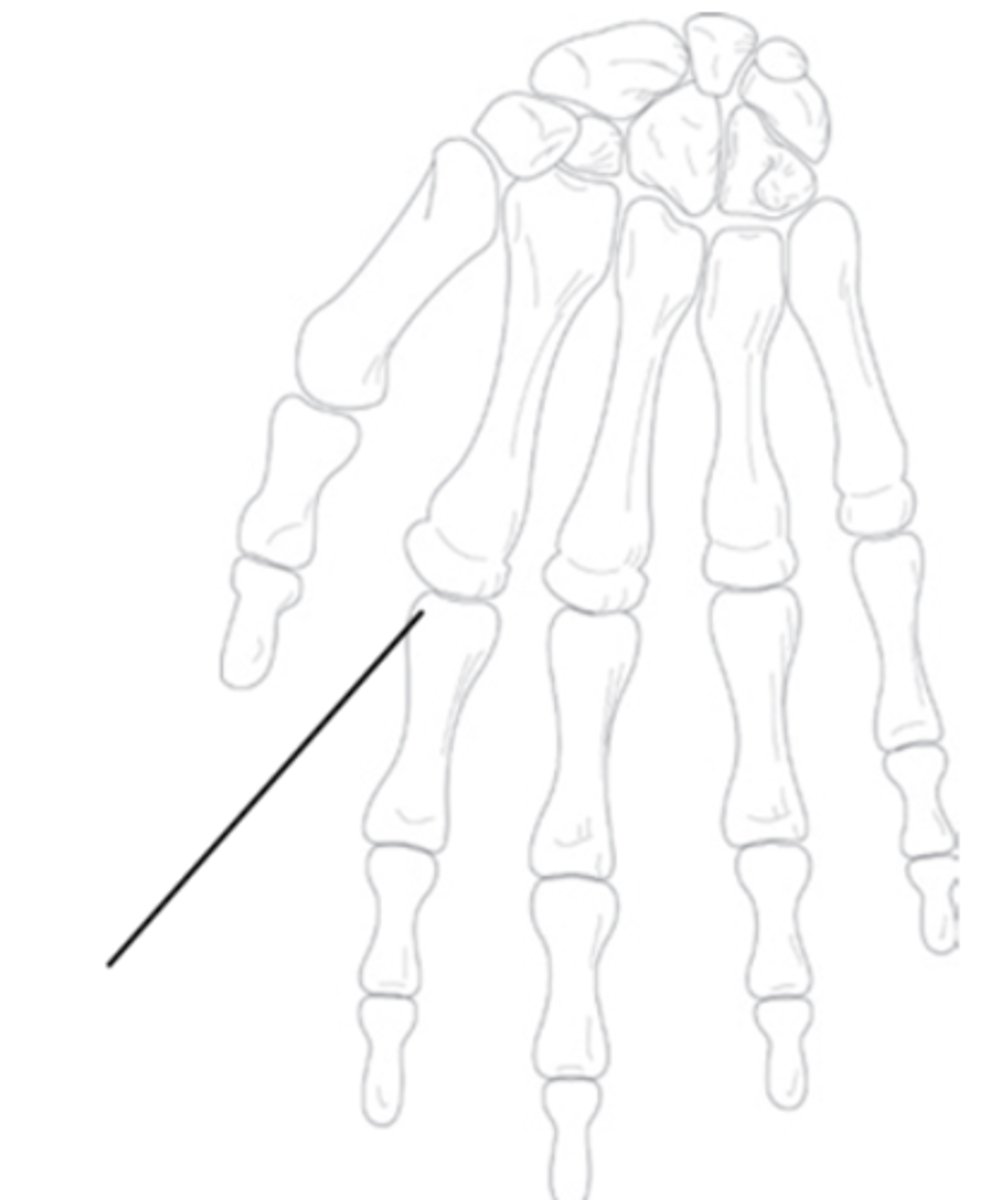 <p>What is the functional classification of this joint?</p>